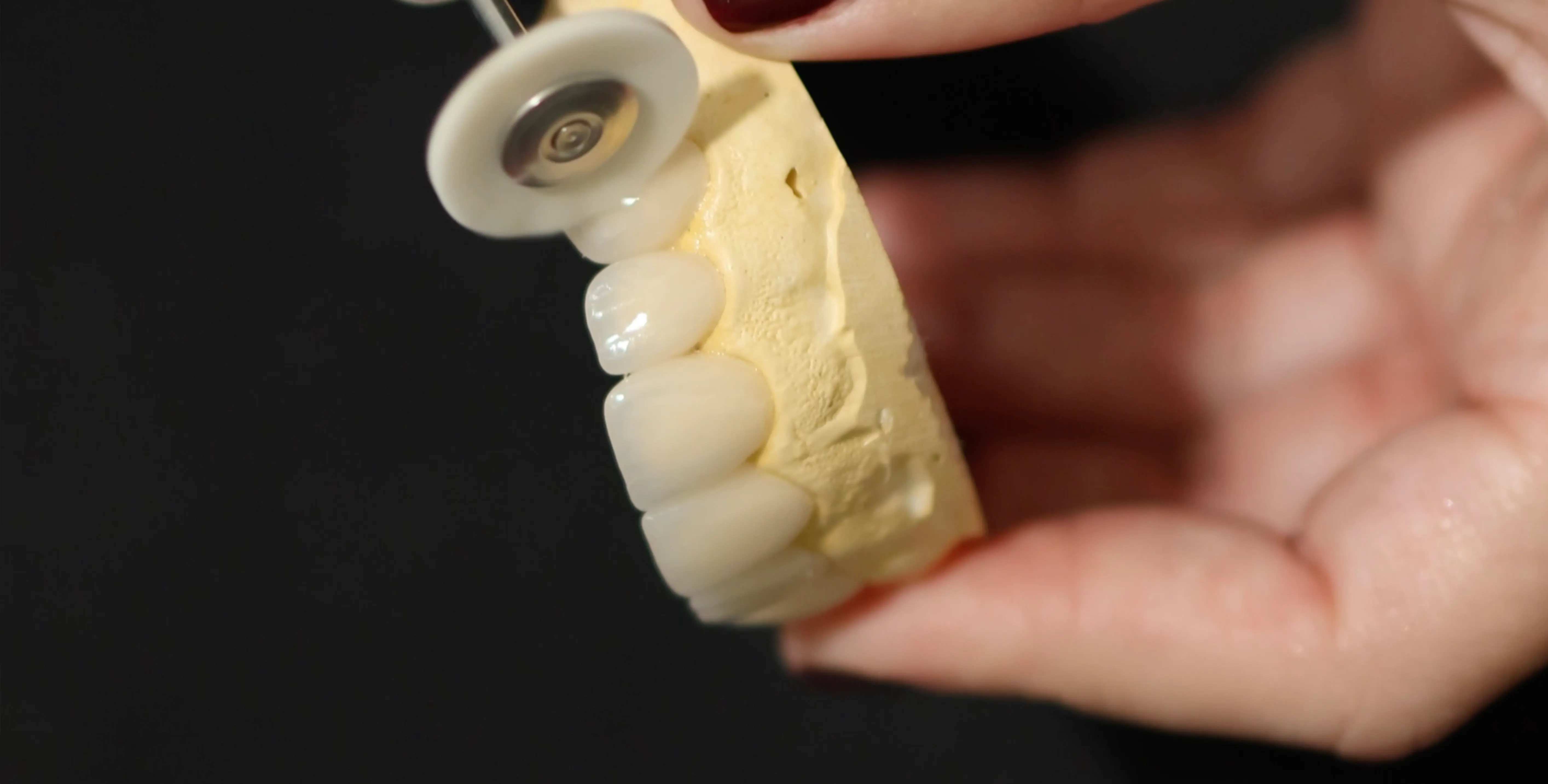 Chairside detail at Beauchamp Dental